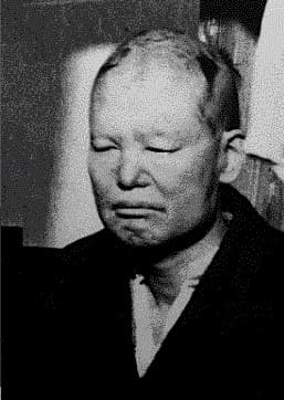 明石海人の画像